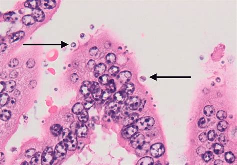  Cryptosporidium: Ein Mikroorganismus, der sich durch Durchfall und Bauchschmerzen bemerkbar macht!