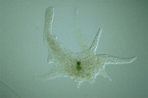  Uranoplasmida! Eine seltene und faszinierende Welt der Amoebozoa